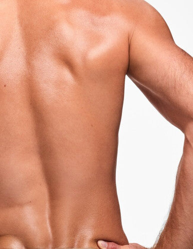 Laser Pigmentation Removal 3/4 Back