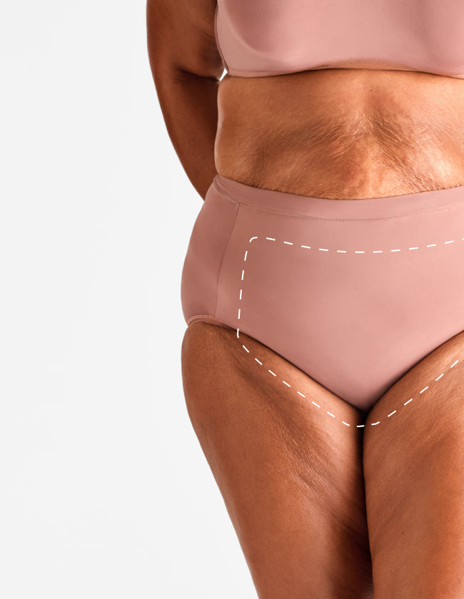 Female Brazilian - Laser Hair Removal