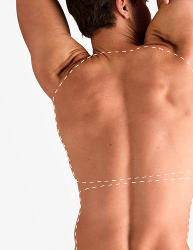 1/2 Back - Laser Hair Removal