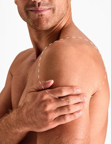 Shoulders - Laser Hair Removal