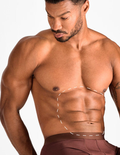 Stomach - Laser Hair Removal