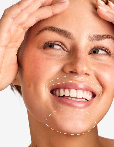 Lip & Chin - Laser Hair Removal