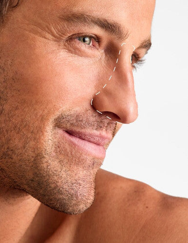 Nose - Laser Hair Removal