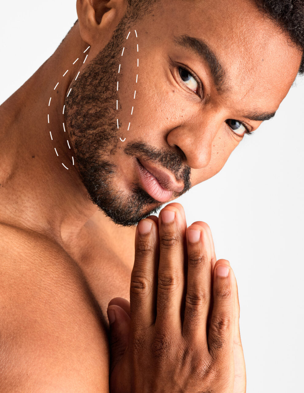 Beard Sculpting - Laser Hair Removal