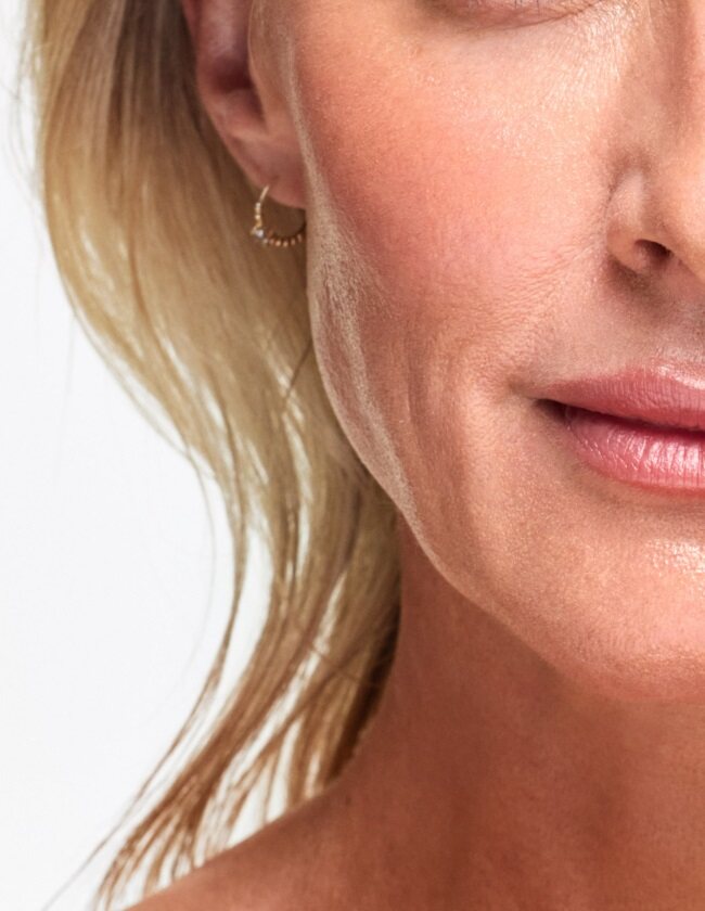 Laser Vascular Single Vein
