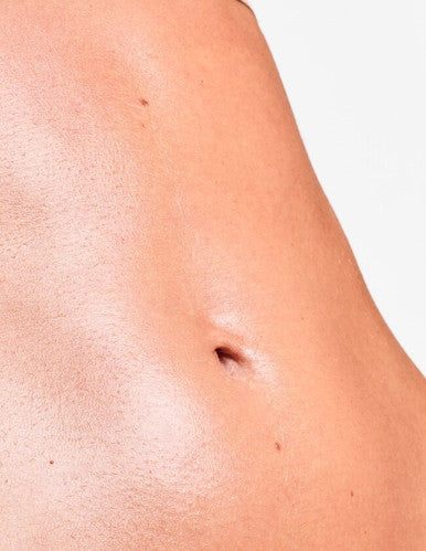 Microneedling Stomach