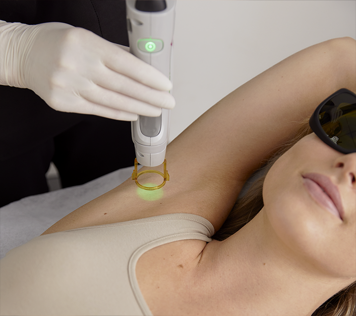 Laser Hair Removal Treatments Laser Clinics United Kingdom