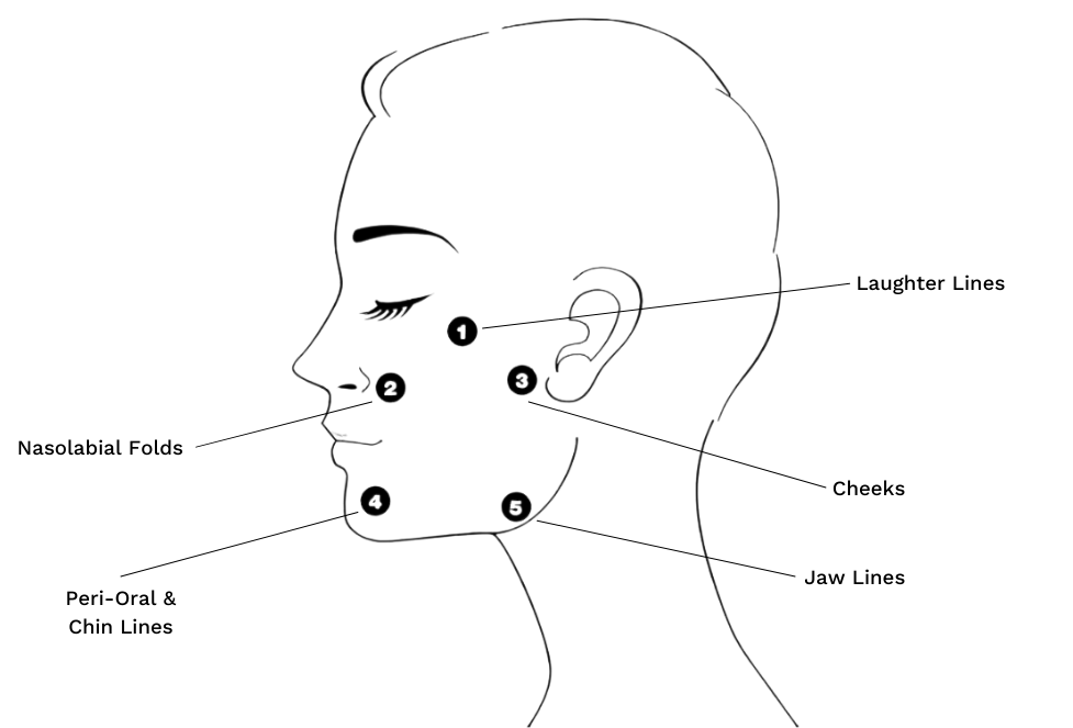 Profhilo® Treatment | Laser Clinics United Kingdom