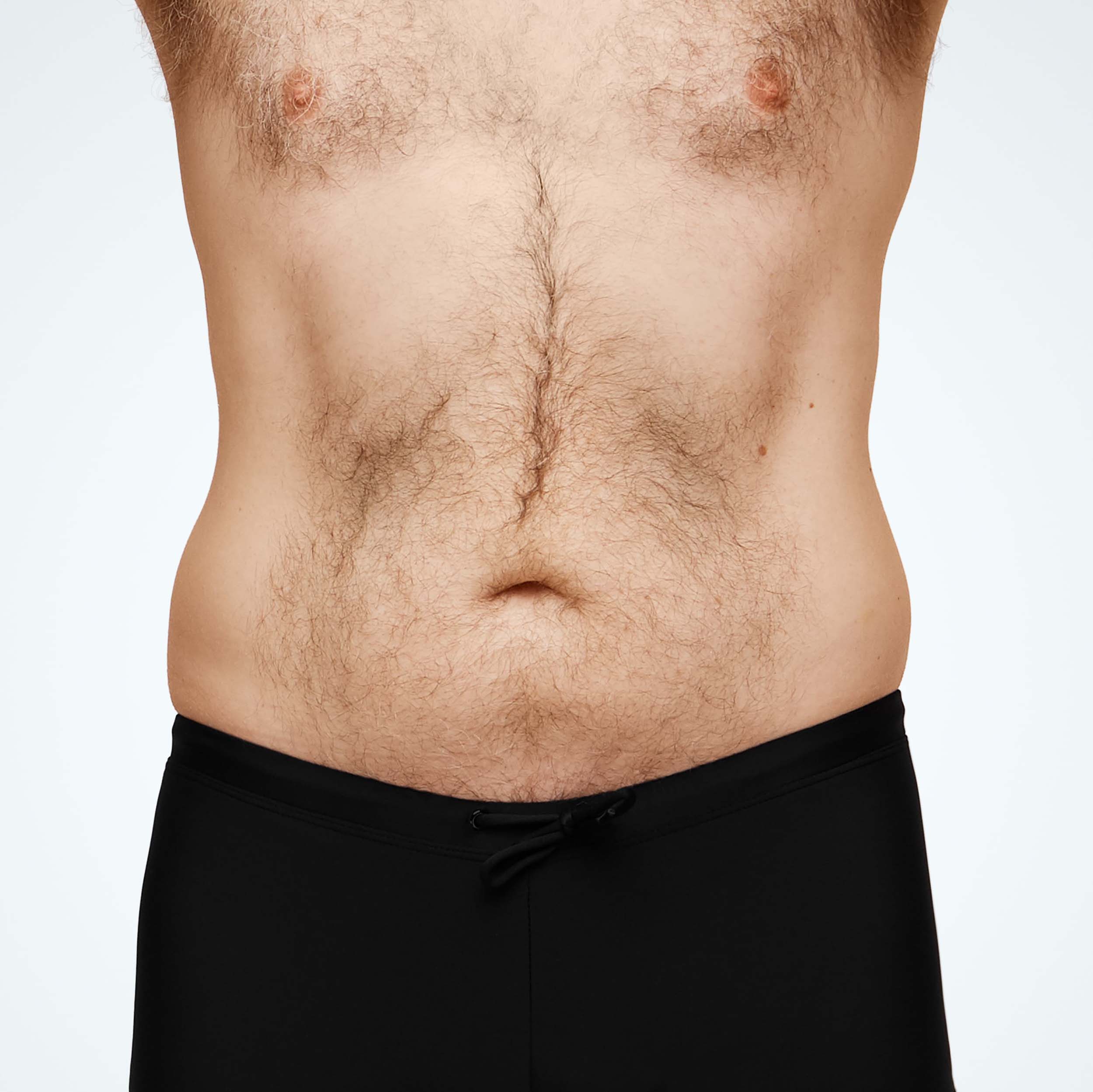 Abdomen_Male_Model2_Mid_Front.jpg